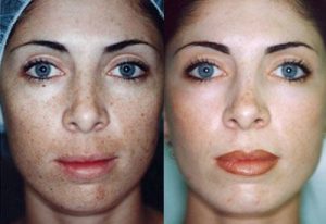 peeling doux Maroc